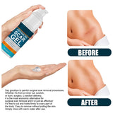 Scar Repair Cream Scar Removal Remove Stretch Marks Pigmentation Corrector Smooth Skin Whitening Body Skin Care 50ml