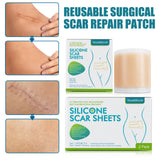 new 150CM Silicone Scar Sheets Skin Repair Patch Removal Self-Adhesive Stretch Mark Tape Therapy Patch Burn Acne Scar Skin Care