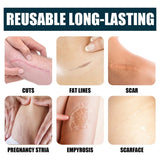 Scar Repair Cream Scar Removal Remove Stretch Marks Pigmentation Corrector Smooth Skin Whitening Body Skin Care 50ml