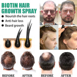 Fast Hair Growth Spray Products Anti Hair Loss Serum Prevent Baldness Treatment Scalp Dry Damaged Beard Hair Care Essential Oils